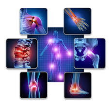 Herbal Pain Relief Course – For Sciatica, Knee & Joint Pain